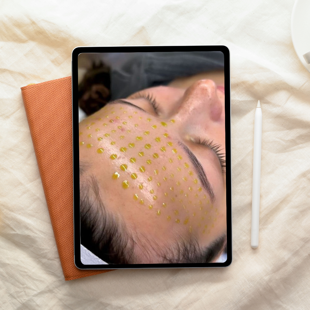 Formation vidéo – Glass Skin (Peeling doux + Nano-needling)
