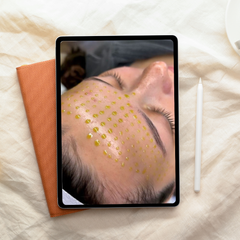 Formation vidéo – Glass Skin (Peeling doux + Nano-needling)